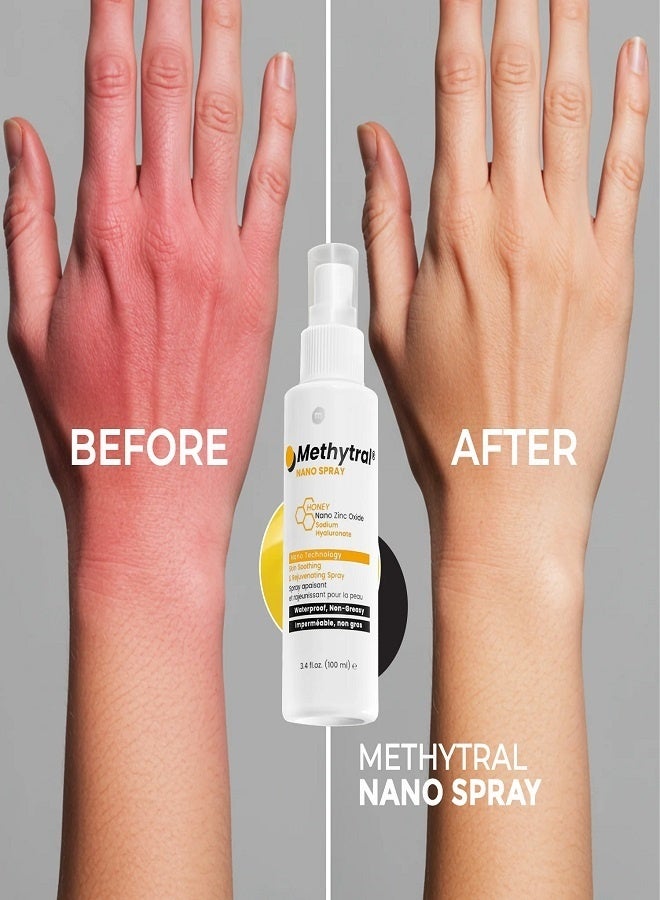 Methytral Nano Spray 100 ml - Image 4